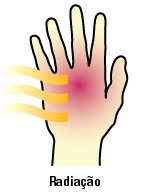 irradiação - queimadura de sol